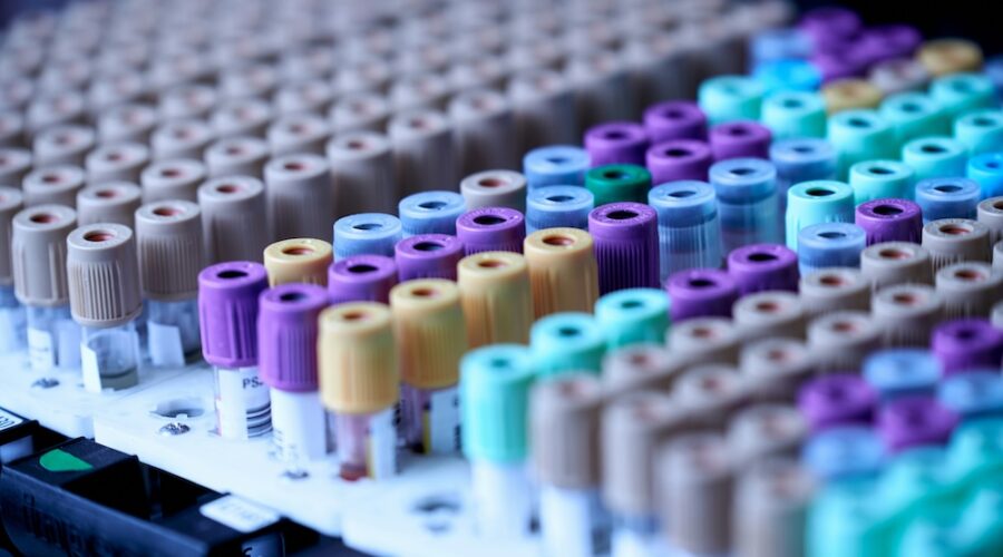 FDA Faces a Core Problem in Psychedelic Trials: Everyone Knows Who Got the Drug